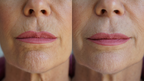 Ageless Lip & Line Filler