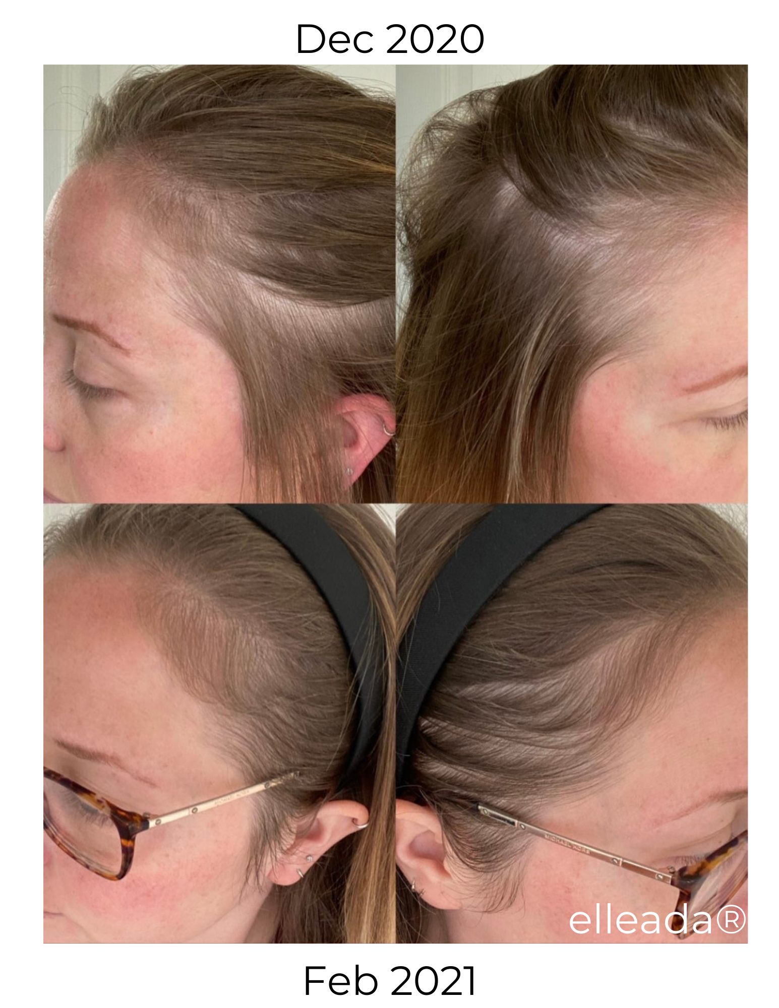 Elleada's Hair Serum