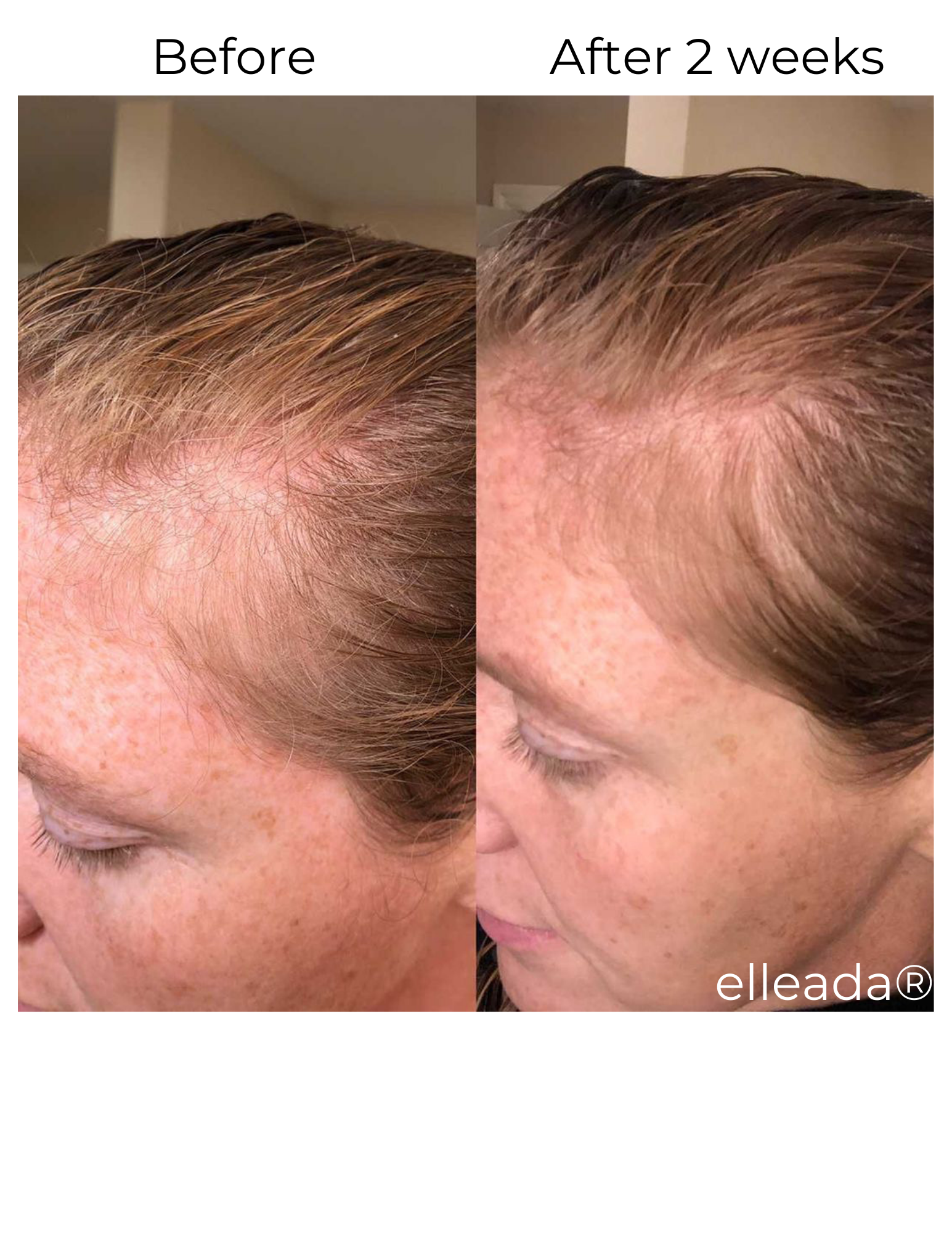 Elleada's Hair Serum