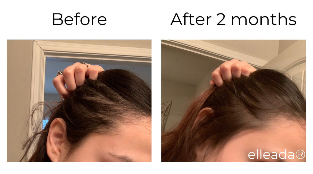 Elleada's Hair Serum