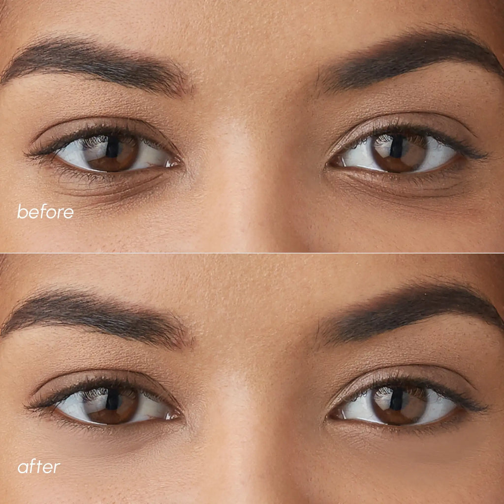 Violet Eye Patches for Dark Circles