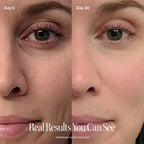 4-in-1 Red Light Therapy Wand & Activating Serum Kit